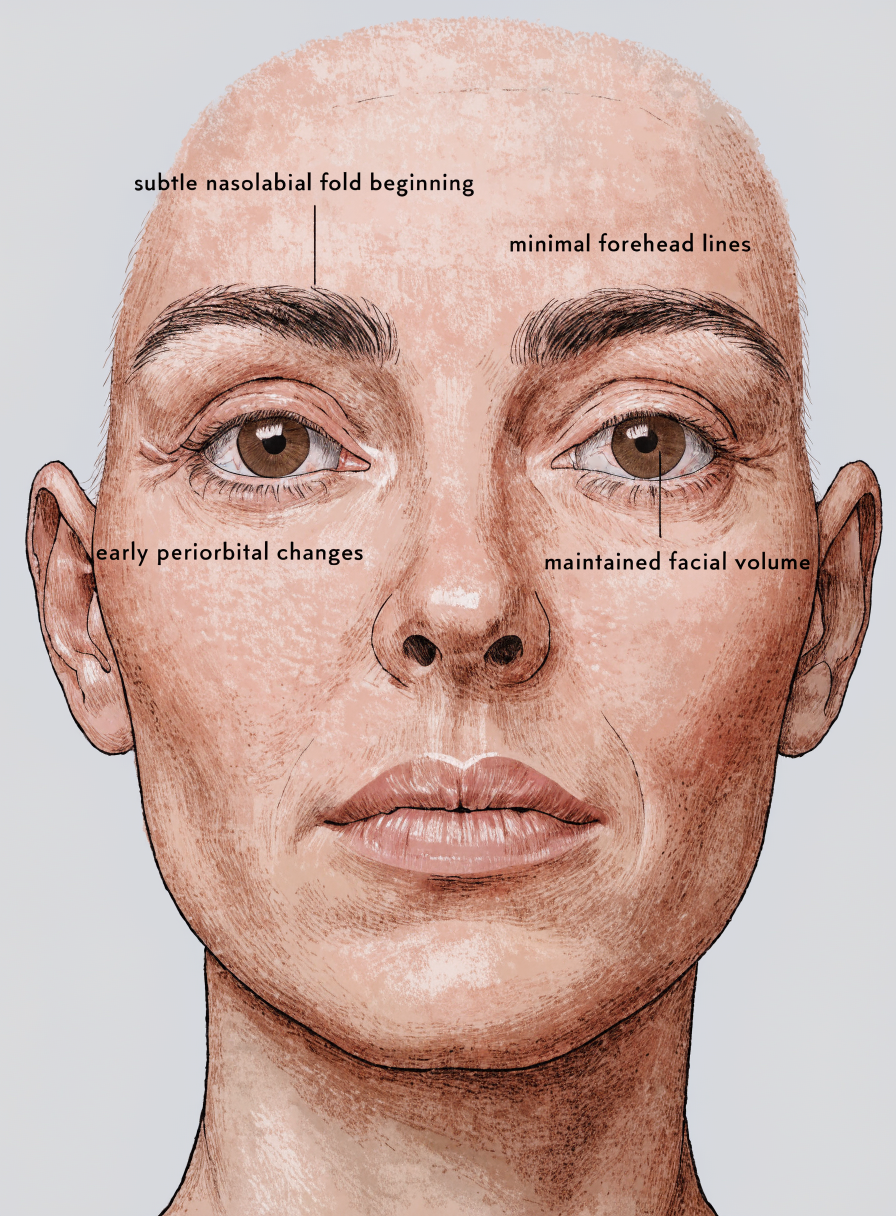 Clinical anatomy — 30s: Early volume shift